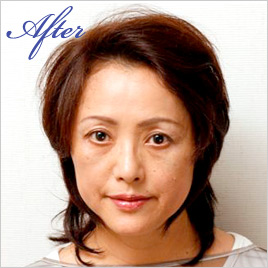 ボワールリフティング